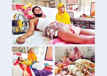 ভবিষ্যৎ নিয়ে দুশ্চিন্তায় আন্দোলনে অঙ্গহারা মানুষ