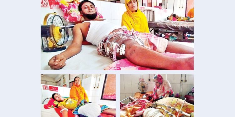 ভবিষ্যৎ নিয়ে দুশ্চিন্তায় আন্দোলনে অঙ্গহারা মানুষ