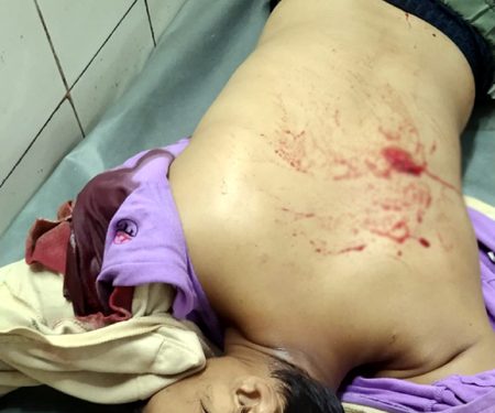 টঙ্গীতে ভাগিনাকে বাঁচাতে গিয়ে ছুরিকাঘাতে মামা গুরুতর আহত