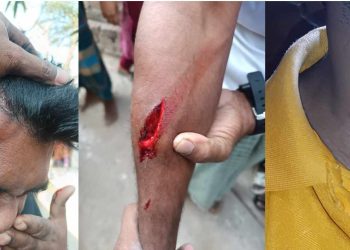 গাজীপুরে সদর উপজেলায় সাংবাদিক পরিবারের ওপর হামলা: নারীসহ আহত ৪ জন