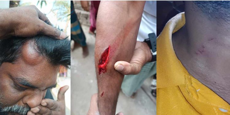 গাজীপুরে সদর উপজেলায় সাংবাদিক পরিবারের ওপর হামলা: নারীসহ আহত ৪ জন