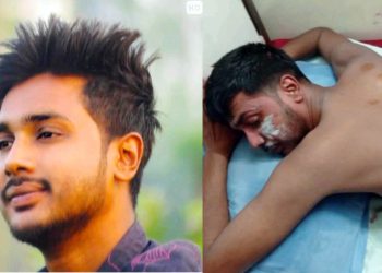 বৈষম্যবিরোধী আন্দোলনে পুলিশের ছোড়া গুলিতে আহত মিলন পায়নি কোন চিকিৎসা সহায়তা-নাম নেই আহতদের তালিকায়