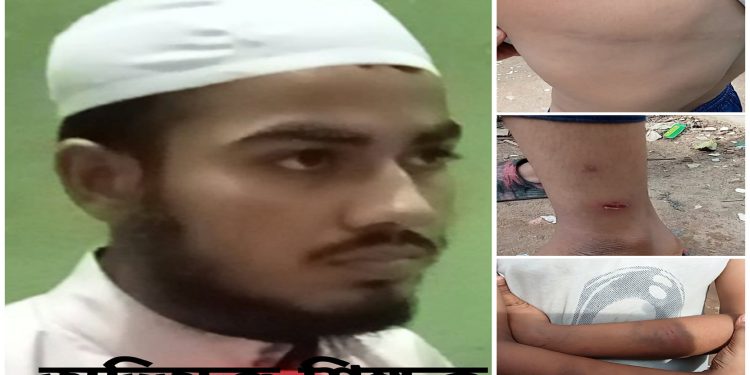 শ্রীপুরে মাদ্রাসা শিক্ষক কর্তৃক ছাত্রকে নির্মমভাবে প্রহার, থানায় অভিযোগ