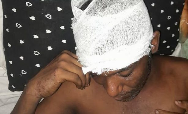 নাটোরের সিংড়ায় জামায়াত ও বিএনপি সমর্থকদের মধ্যে সংঘর্ষ – আহত ১০