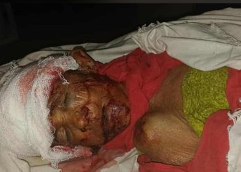 ঠাকুরগাঁওয়ে রাস্তার পাশ থেকে উদ্ধার অজ্ঞাত বৃদ্ধার মৃত্যু, মেলেনি এখনো পরিচয়