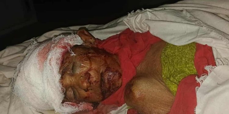 ঠাকুরগাঁওয়ে রাস্তার পাশ থেকে উদ্ধার অজ্ঞাত বৃদ্ধার মৃত্যু, মেলেনি এখনো পরিচয়