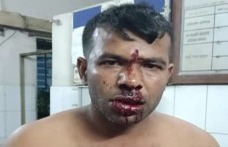 কোটচাঁদপুর উপজেলায় এক কৃষককে কুপিয়ে জখম এলাকায়  নিন্দার ঝড়